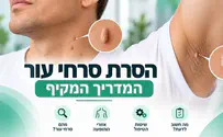 צילום: יח"צ סרחי עור: למה הם מופיעים ואיך מסירים?
