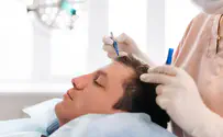 Top 10 best Afro hair transplant clinics in Turkey