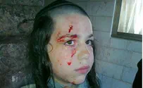 Arabs Wound Boy in Shimon HaTzaddik 