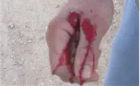 'The Policeman Fired a Burst at Me, I was Full of Blood'