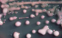 Infant Death from Klebsiella Temporarily Closes Sheba NICU