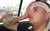 Two Reporters Hurt in Arab Rock Attack