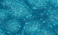 Israel, Japan Unite For First Time to Study Brain, Stem Cells