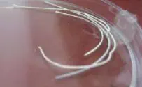 American Friends of Tel Aviv University New Wound Dressing Mimics Skin, Dissolves When Finished