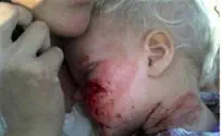 Arabs Throw Rocks at 20 Month Old Baby 