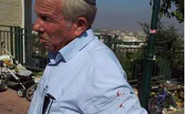 פעילי ימין קיצוני פצעו את יואל צור