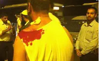 Arab Terrorist Stabs Bus Driver