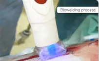New Advanced ‘Seamless’ Incision Closure Technology