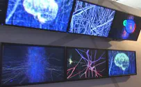 Brain Exhibit Highlights Israeli Achievements