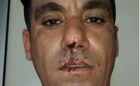Eritreans Attack Family: 'I Thought Eyal was Dead'