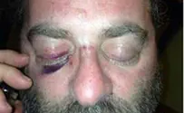 Brooklyn: Jew Hurt in Anti-Semitic Attack