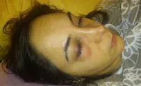 'He Grabbed Me and Pounded My Face'
