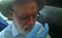 הרב לוינגר נפצע קל מאבנים