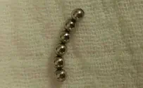חרוזים מגנטיים יצרו חורים במעיו של הפעוט