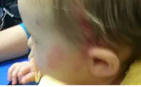 Rock Ambush Injures Baby in Samaria