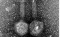 Is a Jerusalem Sewer Bacteria the Cure for Super-Diseases?