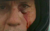 Arab Arrested for Pummeling Jew on Memorial Day