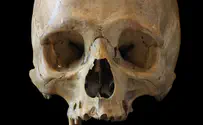 Bones of Nazi victims found in upscale Berlin