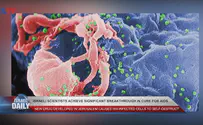 Israeli scientists see significant breakthrough in cure for AIDS