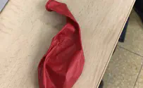 תינוק נחנק מבלון ואיבד את הכרתו