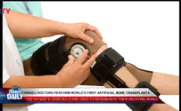 Israelis perform world's first artificial bone transplant