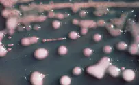 courtesy of USCDC For viral predators of bacteria, sensitivity can be contagious