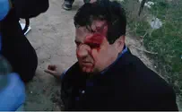 Officers won't stand trial for injuring Arab MK during riots