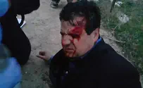 Police interrogated following injury of MK Odeh