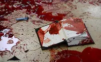 'There was blood everywhere - it was a horrible scene'