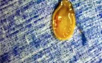 Watermelon seed pulled out of girl's vocal cords