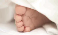 לא תסמונת דאון, תסמונת אפ
