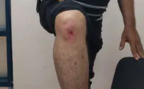 חנה בחניית נכה, קיבל דו"ח - ותקף