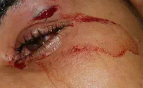 Soldiers attacked in Pardes Hannah