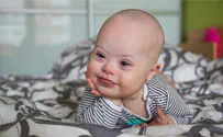 Haredi couple fights abandonment of special needs babies