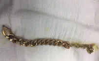 4-year-old swallows metal chain