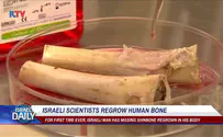 ILTV Israeli scientists regrow human bone
