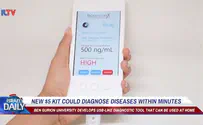 ILTV New $5 kit could diagnose diseases within minutes