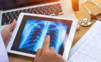 iStock Israeli startup gains FDA approval
