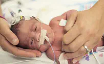 First time in Israel: Cardiac catheterization on tiny baby