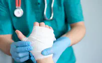 New recruits' hands burned because of direct order