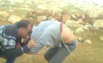 Hilltop youth's parents sue police for alleged assault