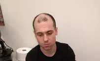 נאשם בתקיפה נמלט מאשפוז פסיכיאטרי