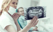 Doctors in India discover 526 teeth in mouth of 7-year old