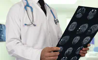 Comprehensive study links coronavirus and stroke in young people