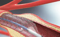 Heart patients may not need surgery, study shows