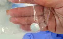 חיי פעוט שבלע גולה ניצלו בבית החולים