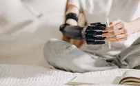 iStock Amputee children given free prosthetics by Israel's Technion
