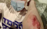 "פצעו אותי בגלל חולצת ליכוד"