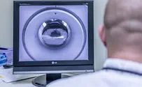 תוך כמה זמן מקבלים פענוח MRI?