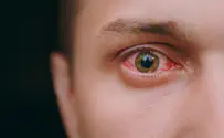 הקורונה והעיניים שלנו